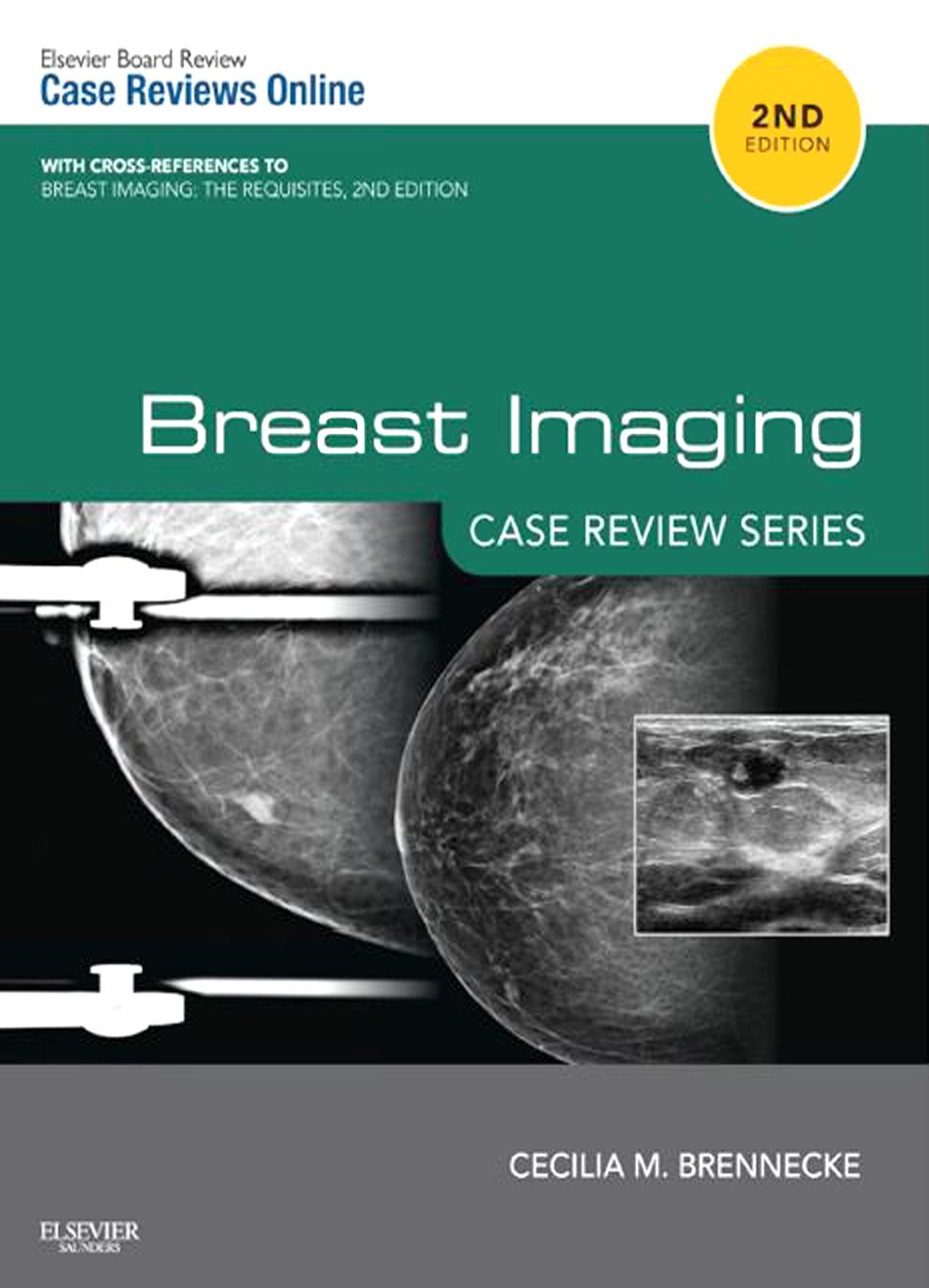 Breast Imaging Case Review Series E Book And Test Scrubs Continuing